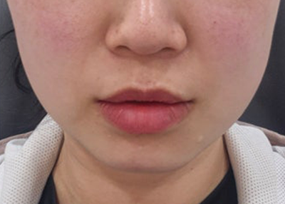 After