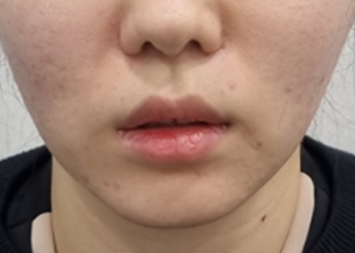 After