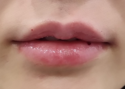 After