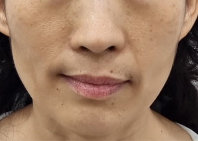 Before